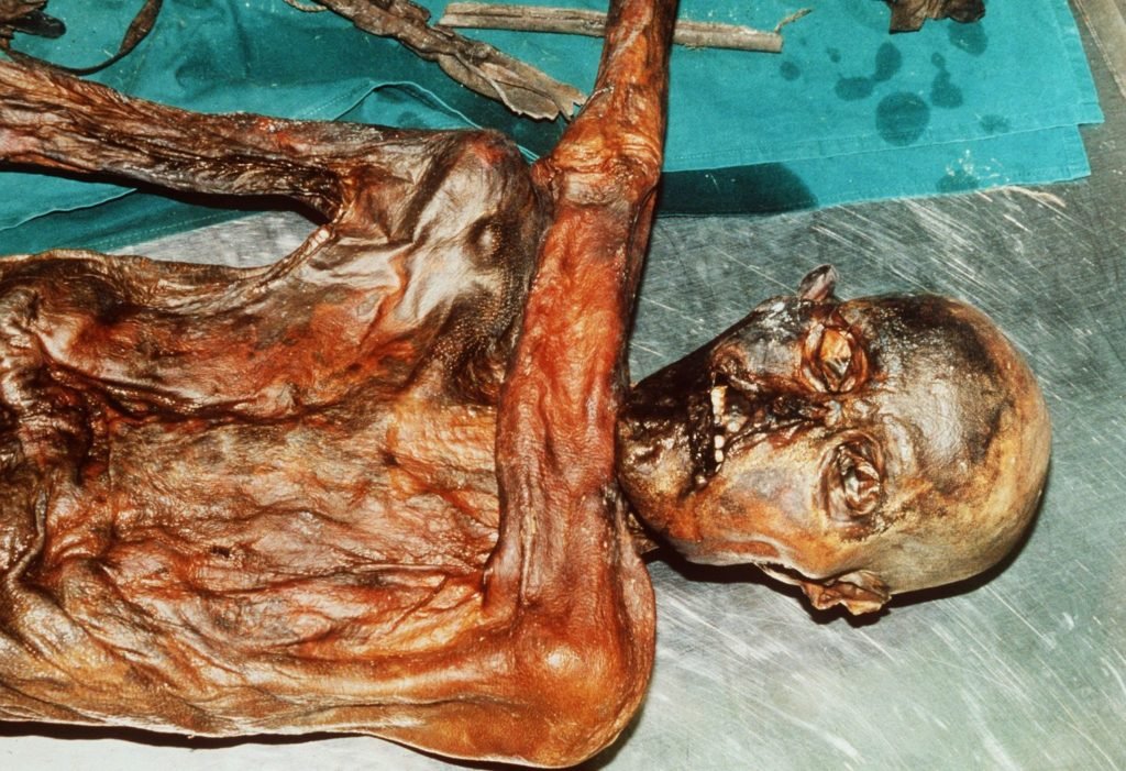 Ötzi Fund