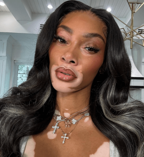 Winnie Harlow Freund